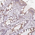 Merck Anti-STYK1 antibody produced in rabbit