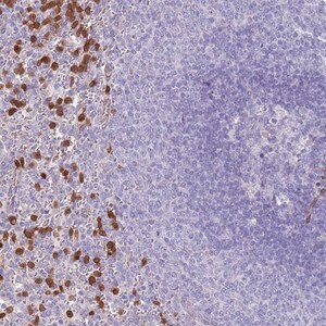 Merck Anti-PHLPP2 antibody produced in rabbit