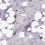 Merck Anti-ZFP62 antibody produced in rabbit