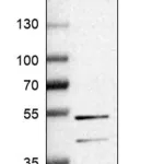 Merck Anti-RAI2 antibody produced in rabbit