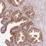 Merck Anti-MINDY2 antibody produced in rabbit