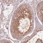 Merck Anti-KIAA1755 antibody produced in rabbit