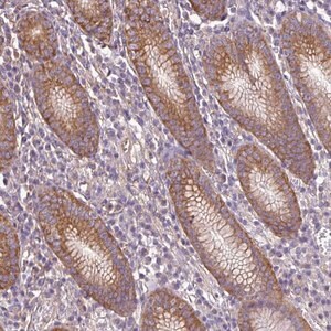 Merck Anti-RP11-849H4.2 antibody produced in rabbit