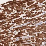 Merck Anti-METRN antibody produced in rabbit