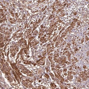 Merck Anti-MAP3K6 antibody produced in rabbit