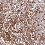 Merck Anti-MAP3K6 antibody produced in rabbit