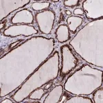 Merck Anti-FKBP10 antibody produced in rabbit