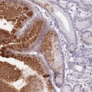 Merck Anti-KCNT2 antibody produced in rabbit