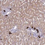 Merck Anti-ZDHHC1 antibody produced in rabbit