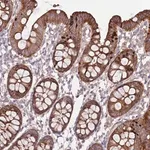 Merck Anti-TOMM5 antibody produced in rabbit
