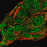 Merck Anti-SERPINA10 antibody produced in rabbit