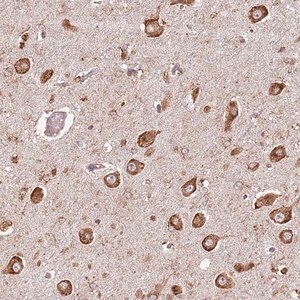 Merck Anti-FAM214B antibody produced in rabbit