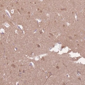 Merck Anti-EMC1 antibody produced in rabbit