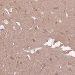 Merck Anti-EMC1 antibody produced in rabbit