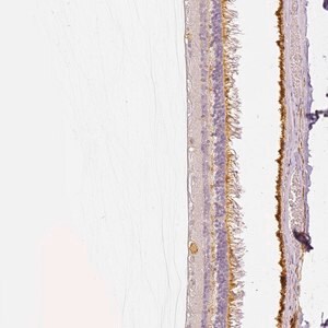 Merck Anti-MYO3A antibody produced in rabbit