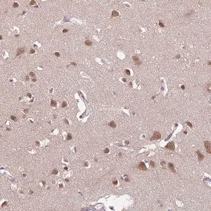 Merck Anti-TFAP2D antibody produced in rabbit
