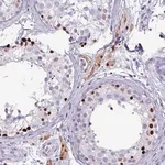 Merck Anti-ZNF816-ZNF321P antibody produced in rabbit