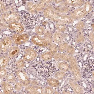 Merck Anti-SLC34A1 antibody produced in rabbit