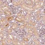 Merck Anti-SLC34A1 antibody produced in rabbit