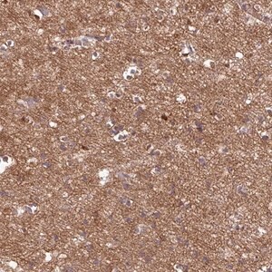 Merck Anti-GABARAPL1 antibody produced in rabbit