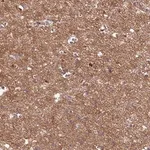 Merck Anti-GABARAPL1 antibody produced in rabbit