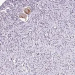 Merck Anti-TTLL3 antibody produced in rabbit