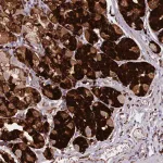 Merck Anti-NDST2 antibody produced in rabbit