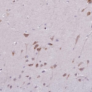 Merck Anti-MAP7D2 antibody produced in rabbit