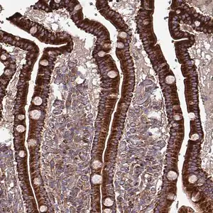 Merck Anti-ANO10 antibody produced in rabbit