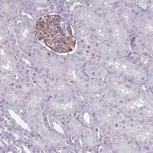 Merck Anti-ROS1 antibody produced in rabbit