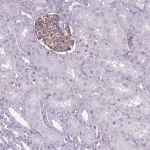 Merck Anti-ROS1 antibody produced in rabbit