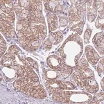 Merck Anti-PARP8 antibody produced in rabbit