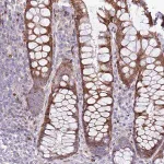 Merck Anti-ANO8 antibody produced in rabbit