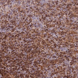 Merck Anti-LYPD6B antibody produced in rabbit