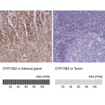 Merck Anti-CYP11B2 antibody produced in rabbit