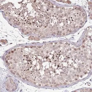 Merck Anti-MEI1 antibody produced in rabbit