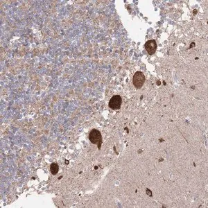 Merck Anti-BTBD18 antibody produced in rabbit