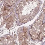 Merck Anti-TMEM232 antibody produced in rabbit