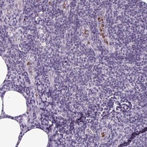 Merck Anti-TMEM11 antibody produced in rabbit