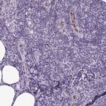 Merck Anti-TMEM11 antibody produced in rabbit