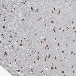 Merck Anti-SAMD14 antibody produced in rabbit