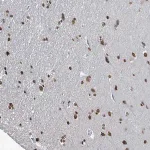 Merck Anti-SAMD14 antibody produced in rabbit