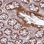 Merck Anti-FAM222B antibody produced in rabbit