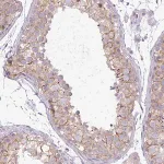 Merck Anti-PNLDC1 antibody produced in rabbit
