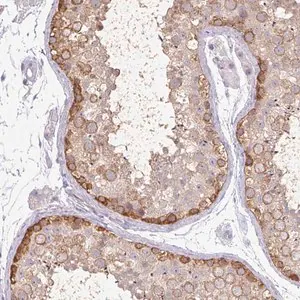 Merck Anti-MAGEC3 antibody produced in rabbit
