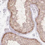 Merck Anti-MAGEC3 antibody produced in rabbit