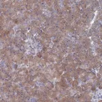 Merck Anti-TMEM128 antibody produced in rabbit