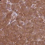 Merck Anti-DCTN3 antibody produced in rabbit