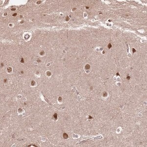 Merck Anti-ST18 antibody produced in rabbit