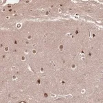 Merck Anti-ST18 antibody produced in rabbit